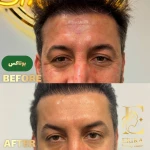  کلینیک زیبایی پوست مو لیزر اریکا