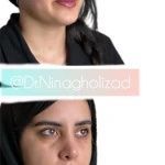  کلینیک زیبایی دکتر نینا قلی زاد