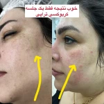مرکز لیزر و کلینیک زیبایی محنا امین