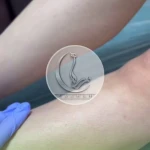 کلینیک زیبایی زرماه
