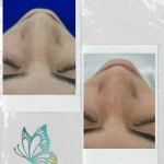  مرکز تخصصی فیشال و ماساژ کیمیا