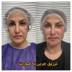 کلینیک زیبایی و لیزر موهای زائد ابریشم