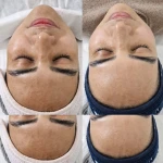  خدمات تخصصی پاکسازی پوست رویال اسکین