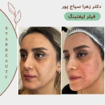کلینیک لیزر و زیبایی پوست دکتر زهرا سیاح پور