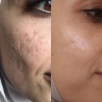 كلينيک پوست مو و زیبایی بيوتا
