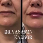 مرکز لیزر کلینیک زیبایی و بوتاکس یاسمینا